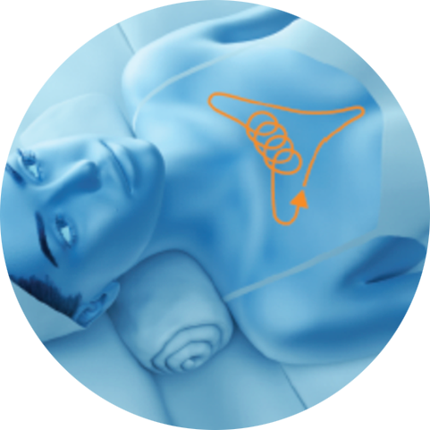 Illustration of a treatment path on the chest for PicoSure Pro laser treatment in London