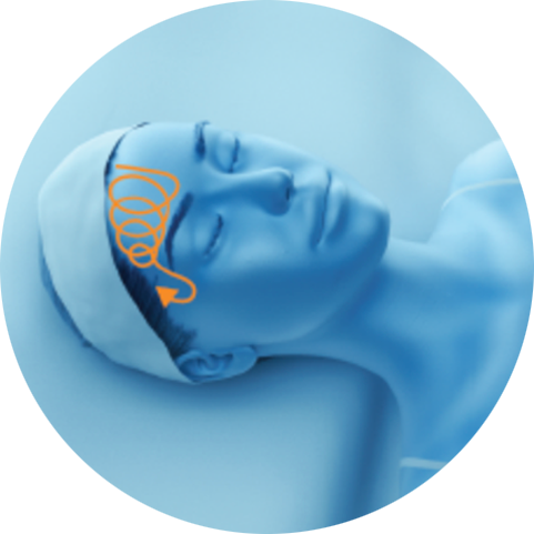 Illustration of a treatment path on the forehead for PicoSure Pro laser treatment in London