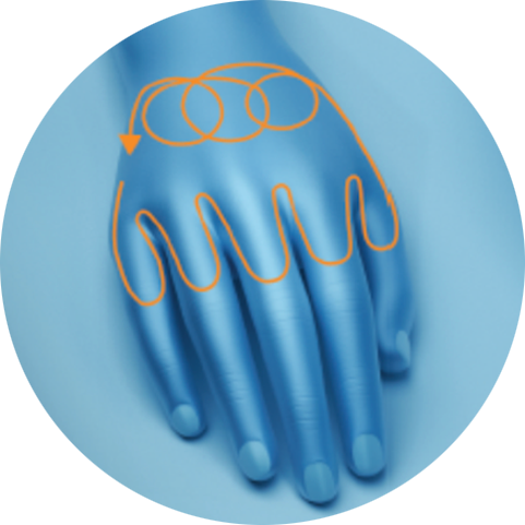 Illustration of a treatment path on the hand for PicoSure Pro laser treatment in London