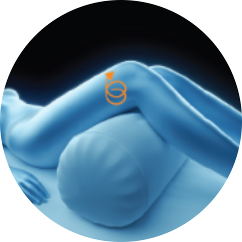 Illustration of a treatment path on the knee for PicoSure Pro laser treatment in London