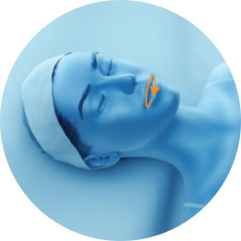 Illustration of a treatment path on the lips for PicoSure Pro laser treatment in London