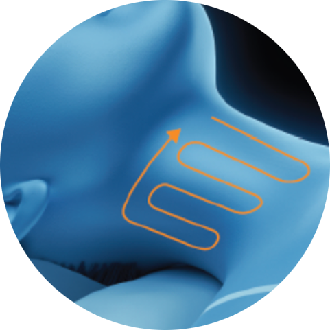 Illustration of a treatment path on the neck for PicoSure Pro laser treatment in London